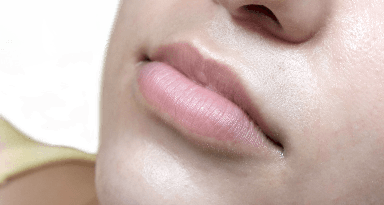 lips_3-Before